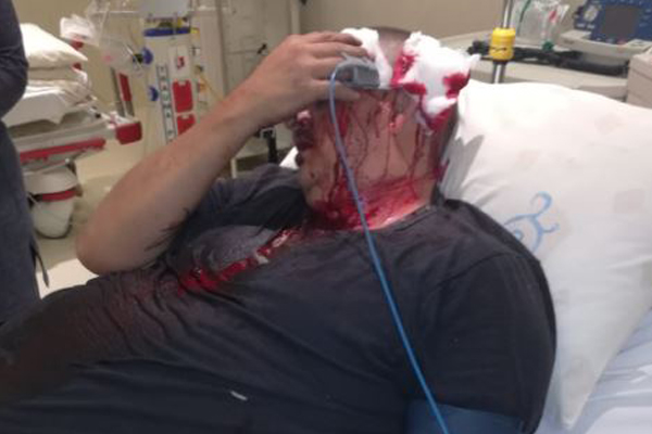 Aanval op man in Ermelo